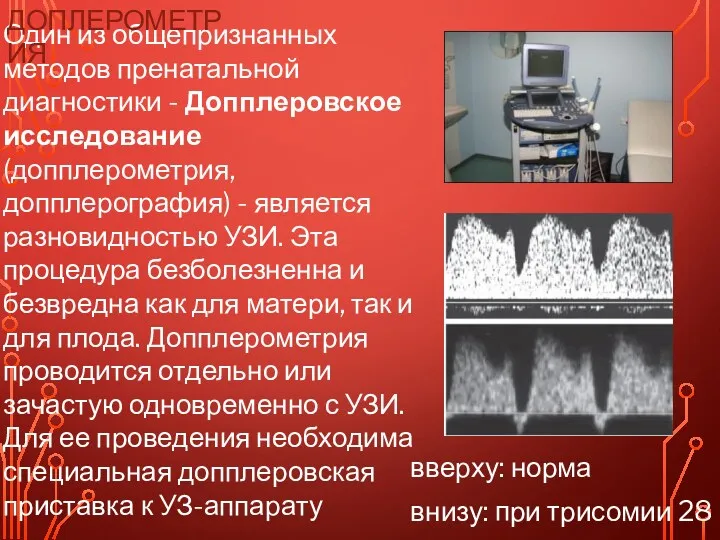 вверху: норма внизу: при трисомии 28 Один из общепризнанных методов пренатальной диагностики -