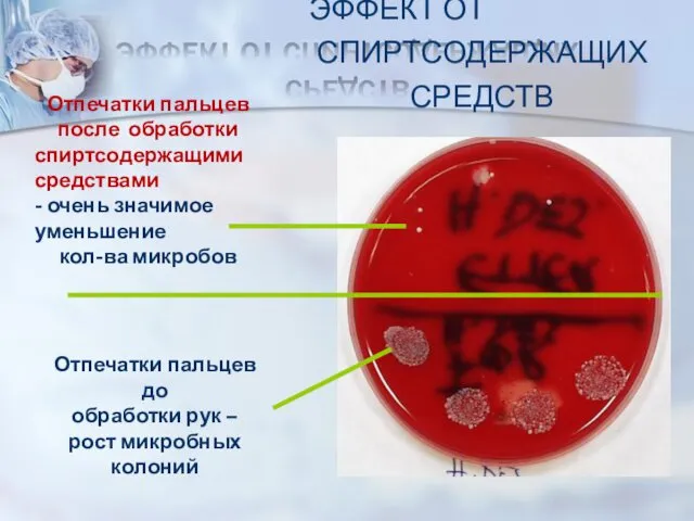 ЭФФЕКТ ОТ СПИРТСОДЕРЖАЩИХ СРЕДСТВ Отпечатки пальцев после обработки спиртсодержащими средствами