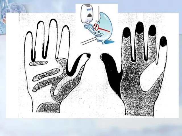 ОБЕЗЗАРАЖИВАНИЕ РУК Зачем? 80% всех инфекций передается через необеззараженные руки