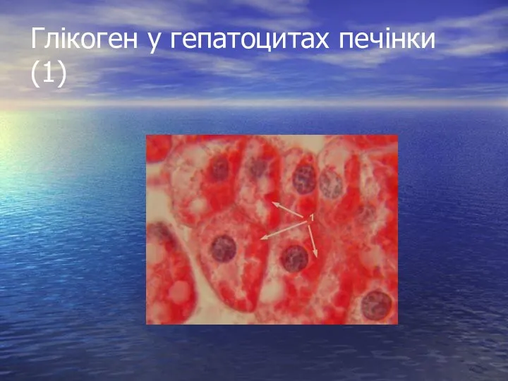 Глікоген у гепатоцитах печінки (1)