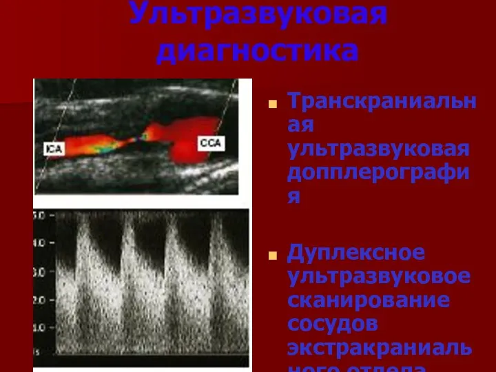 Ультразвуковая диагностика Транскраниальная ультразвуковая допплерография Дуплексное ультразвуковое сканирование сосудов экстракраниального отдела