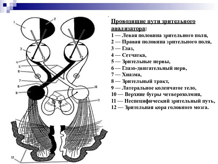 Проводящие пути зрительного анализатора: 1 — Левая половина зрительного поля,