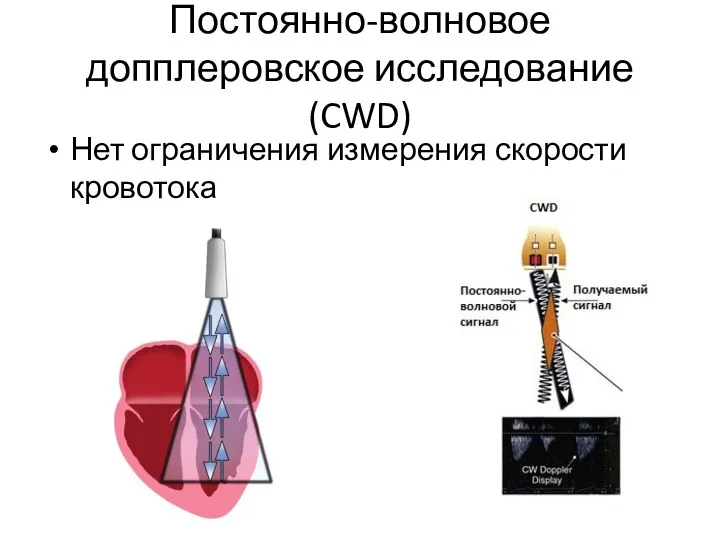 Постоянно-волновое допплеровское исследование (CWD) Нет ограничения измерения скорости кровотока