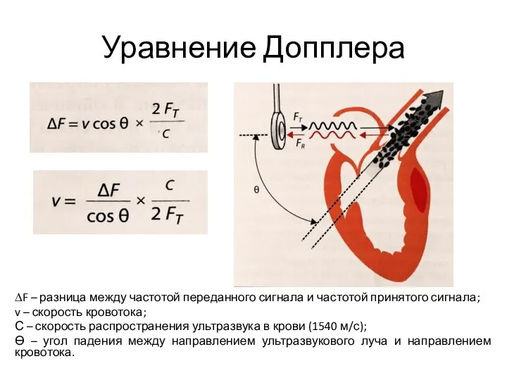 Уравнение Допплера ∆F – разница между частотой переданного сигнала и