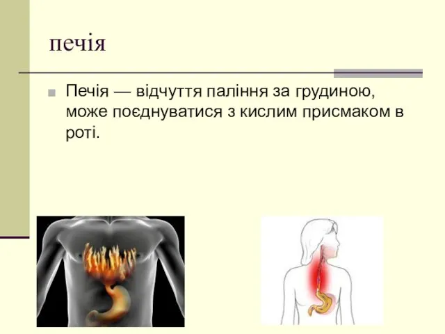 печія Печія — відчуття паління за грудиною, може поєднуватися з кислим присмаком в роті.
