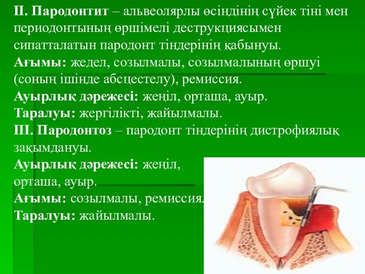 ІІ. Пародонтит – альвеолярлы өсіндінің сүйек тіні мен периодонтының өршімелі