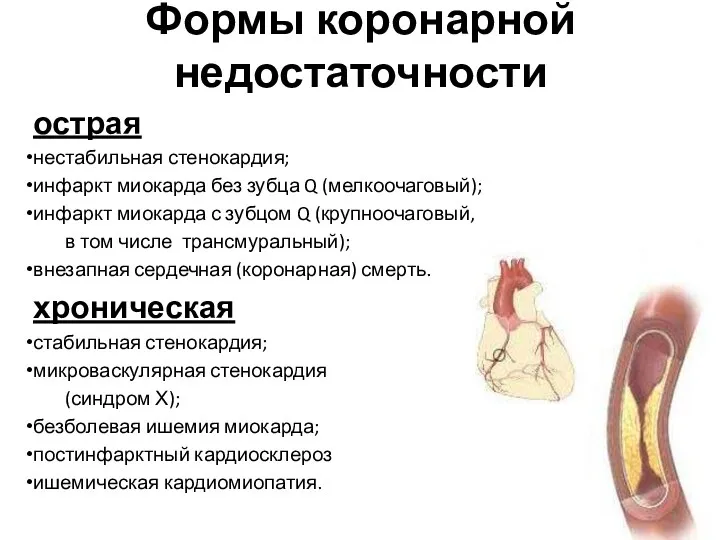 Формы коронарной недостаточности острая нестабильная стенокардия; инфаркт миокарда без зубца