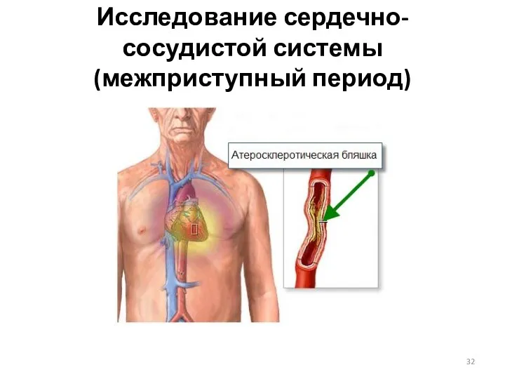 Исследование сердечно-сосудистой системы (межприступный период)