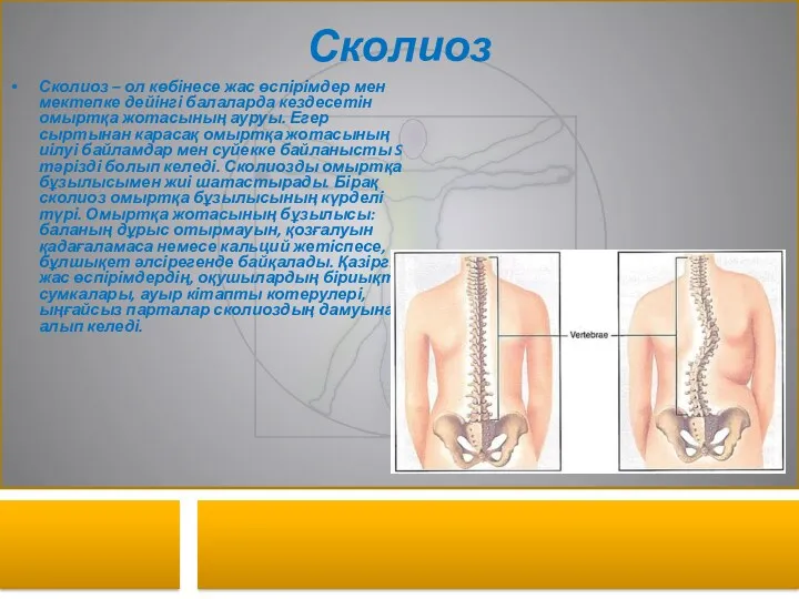 Сколиоз Сколиоз – ол көбінесе жас өспірімдер мен мектепке дейінгі