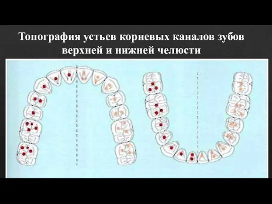 Топография устьев корневых каналов зубов верхней и нижней челюсти