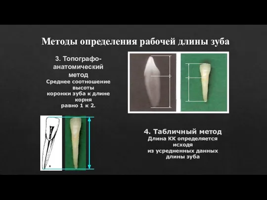 Методы определения рабочей длины зуба 3. Топографо- анатомический метод Среднее соотношение высоты коронки