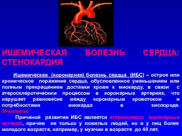 ИШЕМИЧЕСКАЯ БОЛЕЗНЬ СЕРДЦА: СТЕНОКАРДИЯ Ишемическая (коронарная) болезнь сердца (ИБС) – острое или хроническое