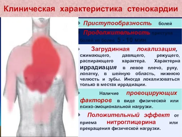 Клиническая характеристика стенокардии