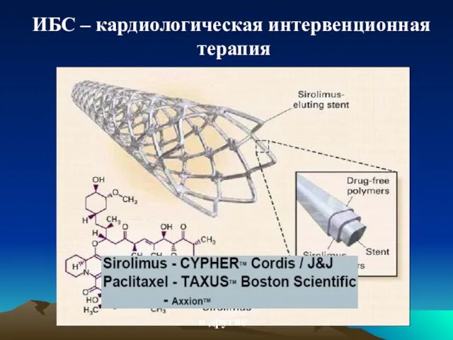 ИБС – кардиологическая интервенционная терапия и другие