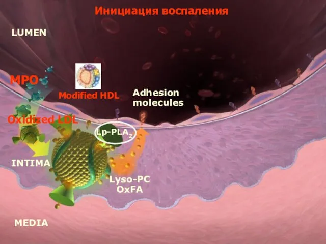 LUMEN MEDIA INTIMA Oxidized LDL Adhesion molecules Lyso-PC OxFA Lp-PLA2 Инициация воспаления MPO Modified HDL