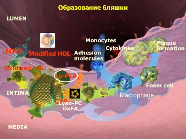 Cytokines Plaque formation Foam cell Monocytes LUMEN MEDIA INTIMA Oxidized