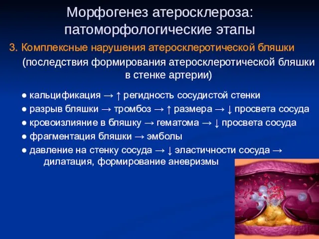 Морфогенез атеросклероза: патоморфологические этапы 3. Комплексные нарушения атеросклеротической бляшки (последствия