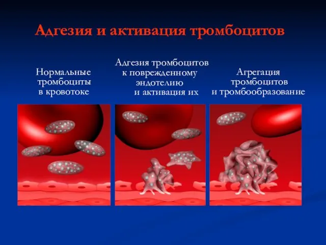 Адгезия и активация тромбоцитов Нормальные тромбоциты в кровотоке Агрегация тромбоцитов