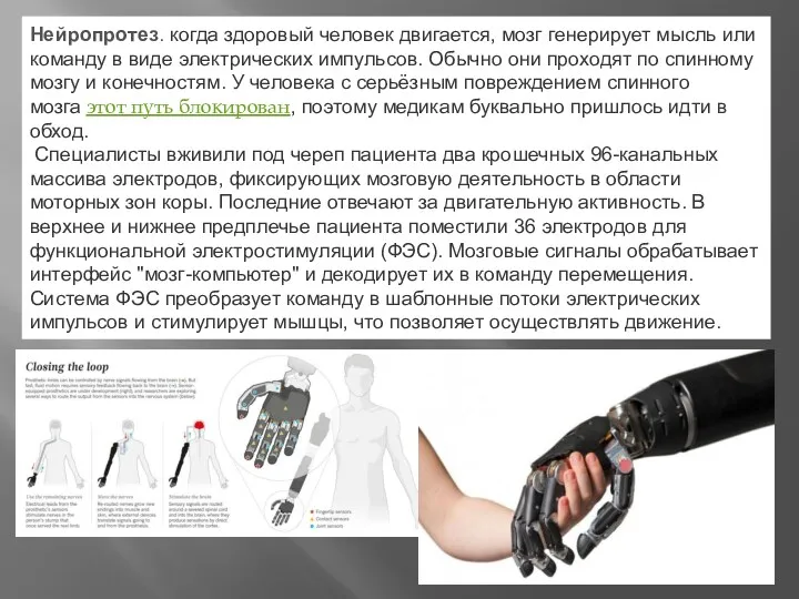 Нейропротез. когда здоровый человек двигается, мозг генерирует мысль или команду