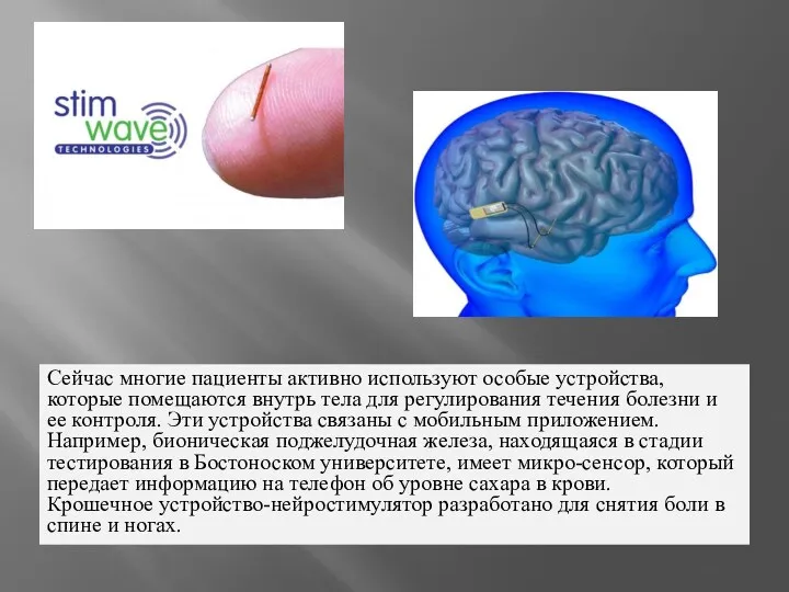 Сейчас многие пациенты активно используют особые устройства, которые помещаются внутрь