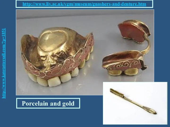 http://www.katetattersall.com/?p=1851 Porcelain and gold http://www.liv.ac.uk/vgm/museum/gnashers-and-denture.htm