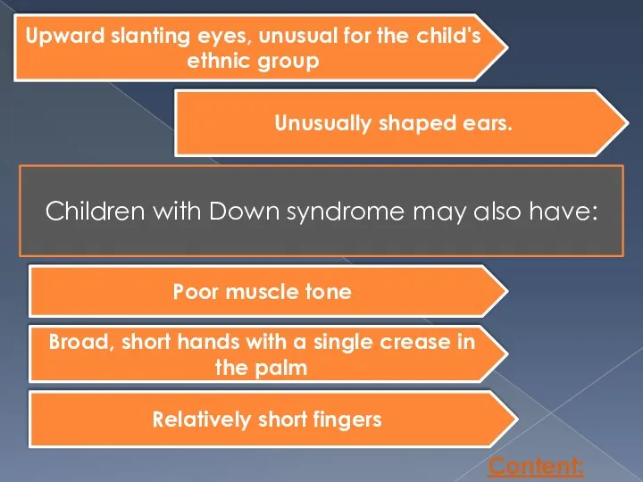 Content: Upward slanting eyes, unusual for the child's ethnic group