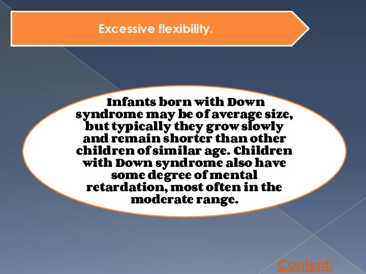 Content: Excessive flexibility. Infants born with Down syndrome may be