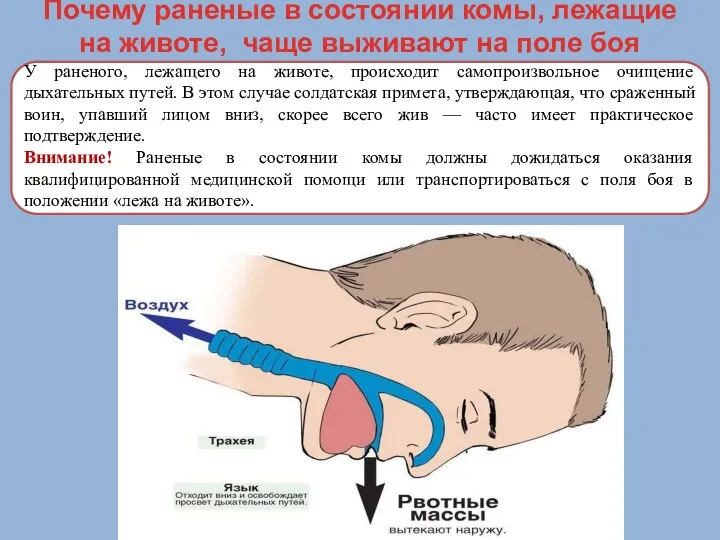 Почему раненые в состоянии комы, лежащие на животе, чаще выживают на поле боя