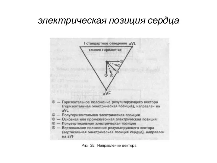 электрическая позиция сердца