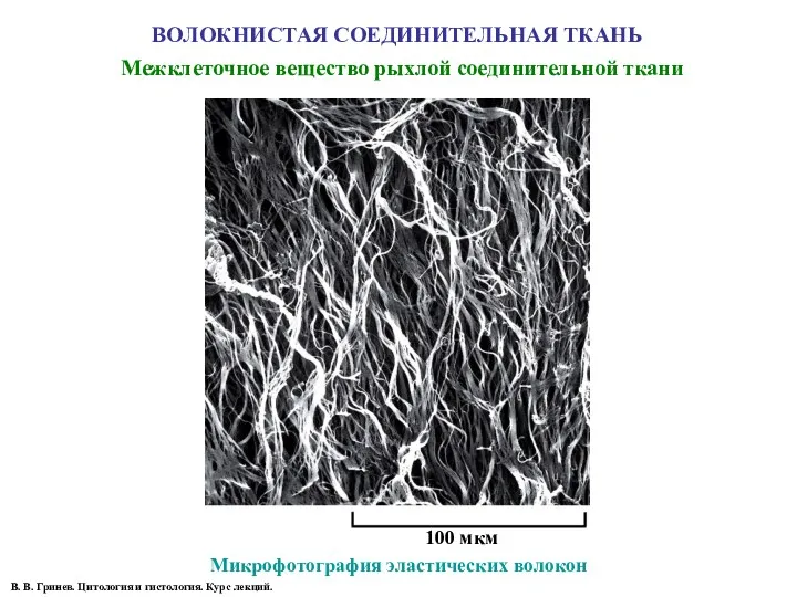 ВОЛОКНИСТАЯ СОЕДИНИТЕЛЬНАЯ ТКАНЬ Микрофотография эластических волокон 100 мкм Межклеточное вещество