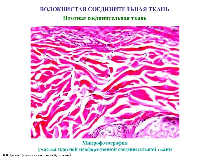 ВОЛОКНИСТАЯ СОЕДИНИТЕЛЬНАЯ ТКАНЬ Плотная соединительная ткань Микрофотография участка плотной неоформленной