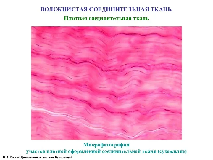 ВОЛОКНИСТАЯ СОЕДИНИТЕЛЬНАЯ ТКАНЬ Плотная соединительная ткань Микрофотография участка плотной оформленной