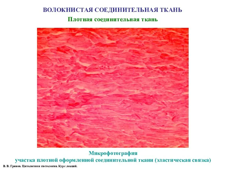 ВОЛОКНИСТАЯ СОЕДИНИТЕЛЬНАЯ ТКАНЬ Плотная соединительная ткань Микрофотография участка плотной оформленной