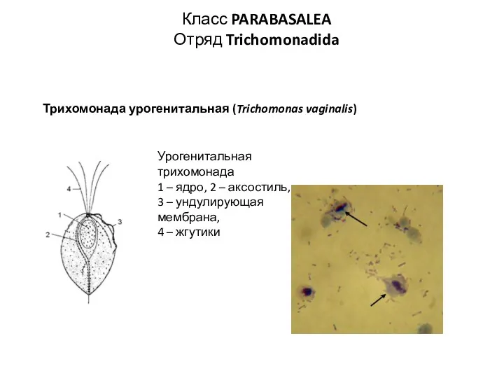 Трихомонада урогенитальная (Trichomonas vaginalis) Урогенитальная трихомонада 1 – ядро, 2