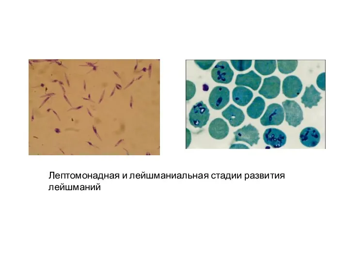 Лептомонадная и лейшманиальная стадии развития лейшманий