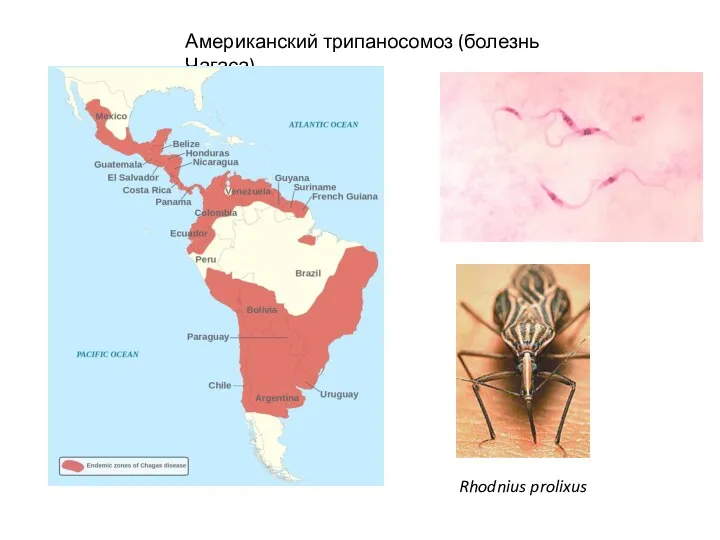 Американский трипаносомоз (болезнь Чагаса) Rhodnius prolixus
