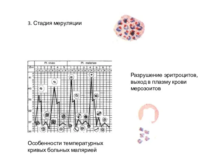 3. Стадия меруляции Особенности температурных кривых больных малярией Разрушение эритроцитов, выход в плазму крови мерозоитов