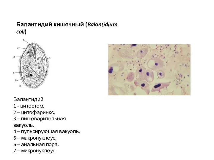 Балантидий кишечный (Balantidium coli) Балантидий 1 - цитостом, 2 –