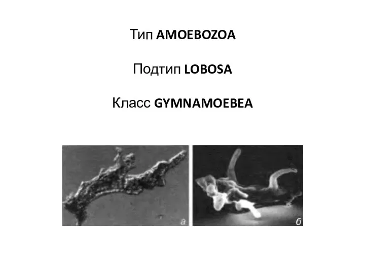 Тип AMOEBOZOA Подтип LOBOSA Класс GYMNAMOEBEA