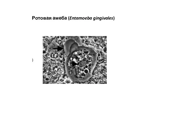 Ротовая амеба (Entamoeba gingivales) )