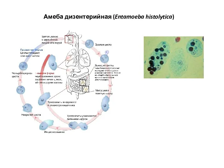 Амеба дизентерийная (Entamoeba histolytica)