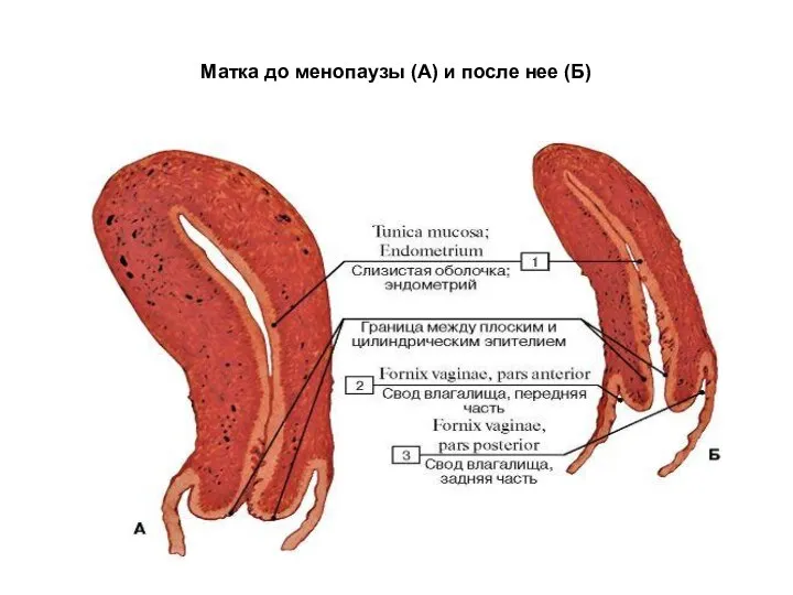 Матка до менопаузы (А) и после нее (Б)