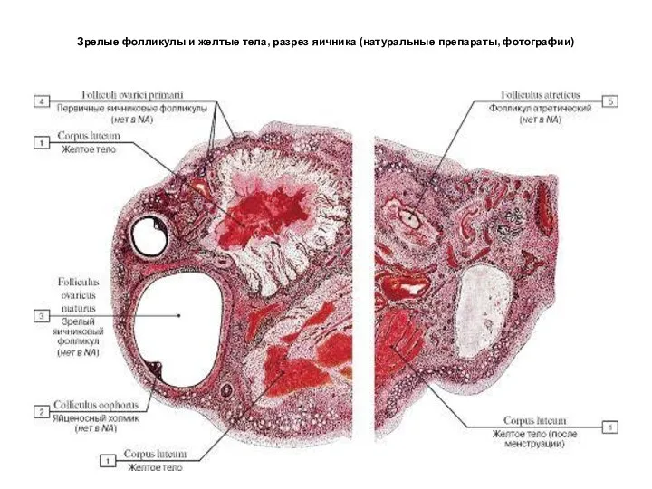Зрелые фолликулы и желтые тела, разрез яичника (натуральные препараты, фотографии)