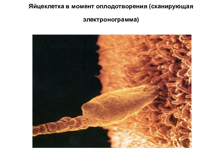 Яйцеклетка в момент оплодотворения (сканирующая электронограмма)