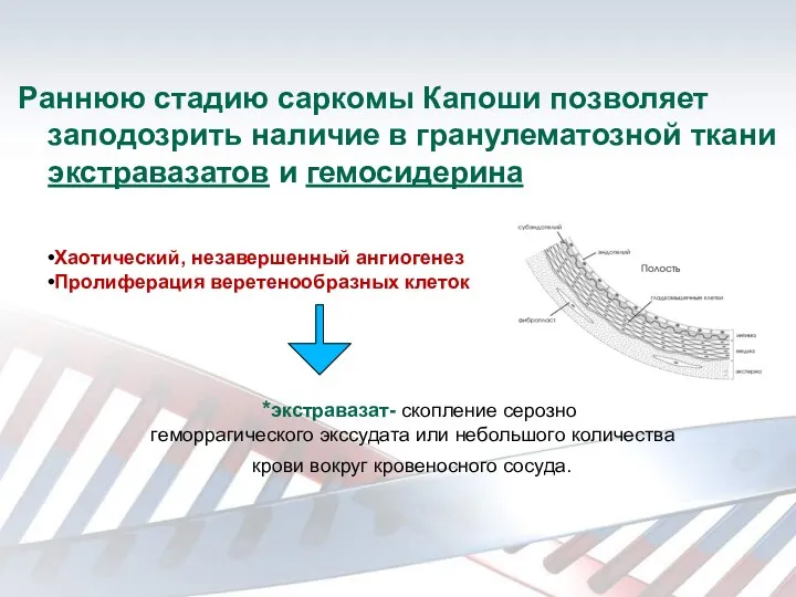 Раннюю стадию саркомы Капоши позволяет заподозрить наличие в гранулематозной ткани