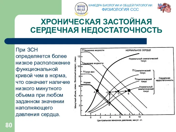 ХРОНИЧЕСКАЯ ЗАСТОЙНАЯ СЕРДЕЧНАЯ НЕДОСТАТОЧНОСТЬ При ЗСН определяется более низкое расположение функциональной кривой чем