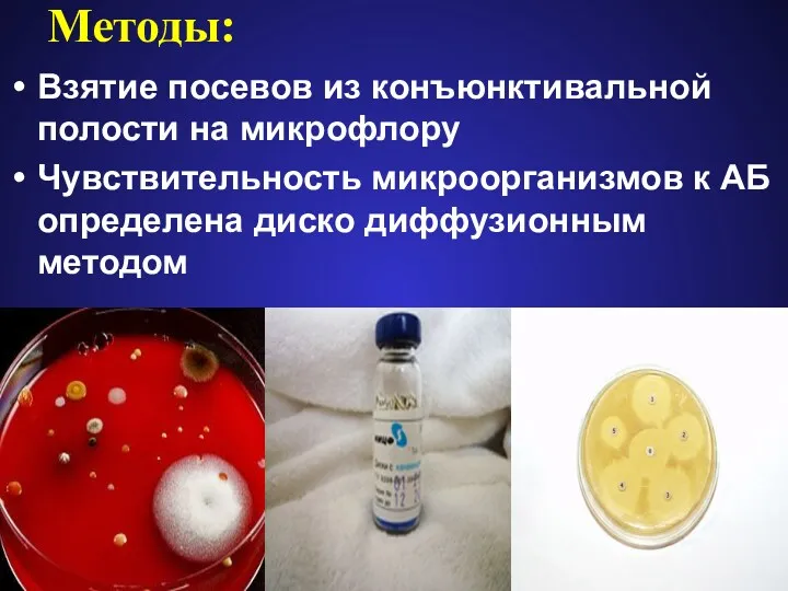 Методы: Взятие посевов из конъюнктивальной полости на микрофлору Чувствительность микроорганизмов к АБ определена диско диффузионным методом