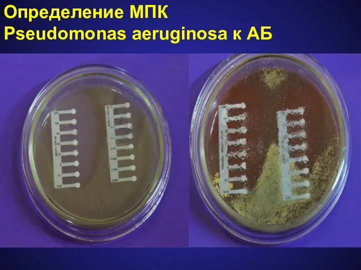 Определение МПК Pseudomonas aeruginosa к АБ