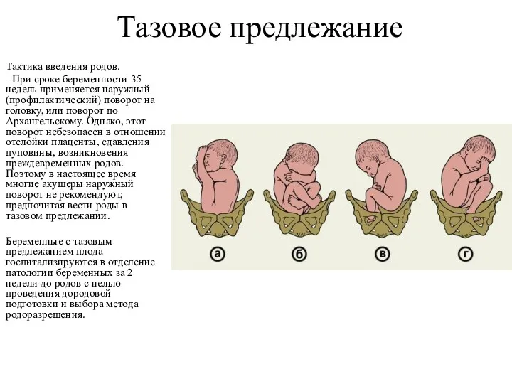 Тазовое предлежание Тактика введения родов. - При сроке беременности 35 недель применяется наружный