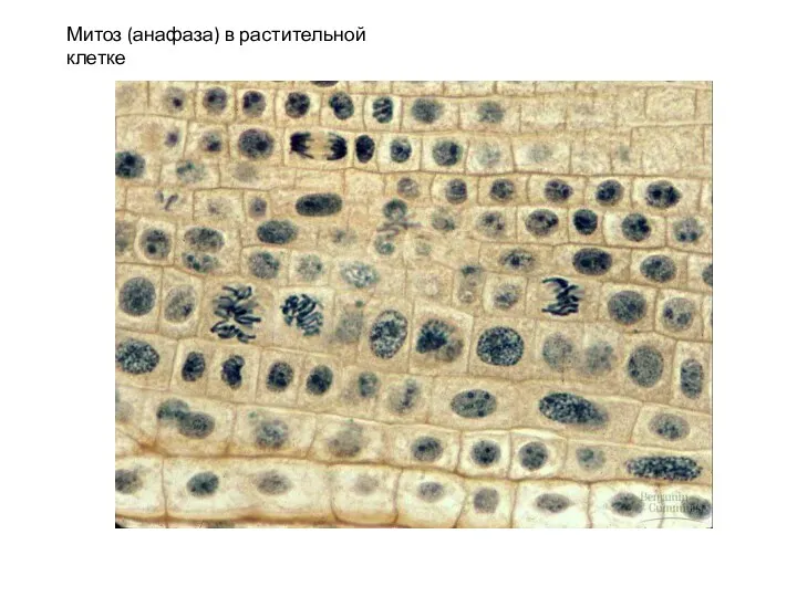 Митоз (анафаза) в растительной клетке